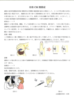 母指 CM 関節症