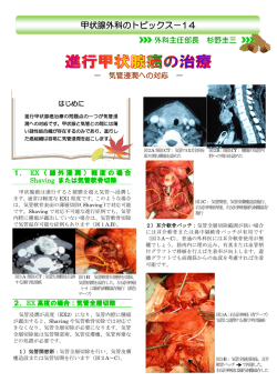 進行甲状腺癌の治療 －気管浸潤への対応