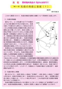 第11回 乳癌の発癌と進展（1）