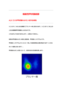 機能性甲状腺結節