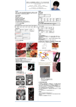 填材なしの上顎洞底拳上と即時HAインプラント埋入術の20例 【目的