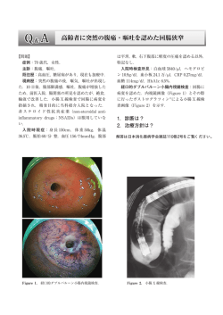高齢者に突然の腹痛・嘔吐を認めた回腸狭窄