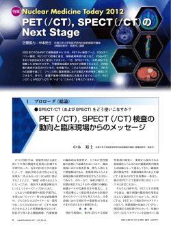 SPECT/CT（およびSPECT）をどう使いこなすか？