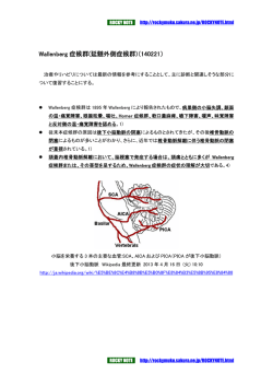 Wallenberg 症候群(延髄外側症候群)（140221）