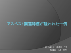 アスベスト関連肺癌が疑われた一例
