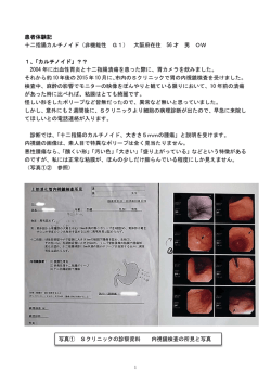 患者体験記 十二指腸カルチノイド（非機能性 G1） 大阪府在住 56 才 男