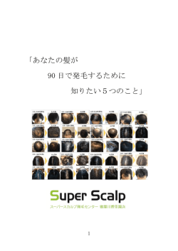 あなたの髪が 90 日で発毛するために 知りたい5つのこと