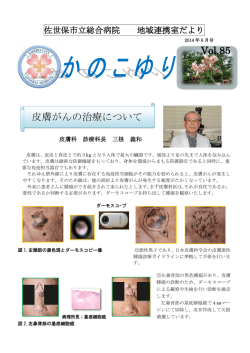 Vol.85 皮膚がんの治療について