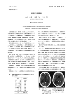 転移性脳腫瘍 - 日本医科大学