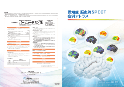 認知症 脳血流SPECT 症例アトラス