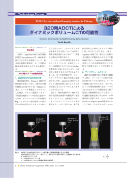 320列ADCTによる ダイナミックボリュームCTの可能性 320列ADCT