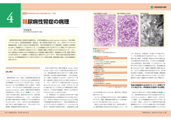 糖尿病性腎症の病理