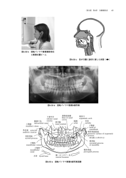 図4.50 b 回転パノラマ断層撮影体位 と断層位置ビーム 図4.50 d 回転