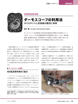 ダーモスコピーに関する医師向け説明