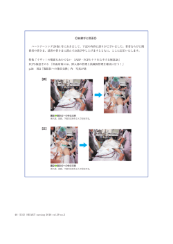 正誤表（PDF形式）