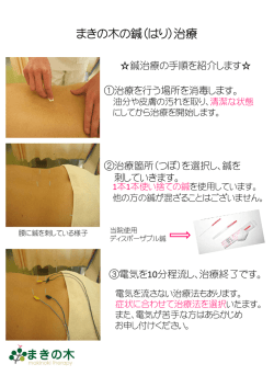 まきの木の鍼（はり）治療