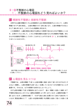 1．不整脈の心電図をどう見ればよいか？