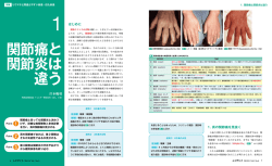 関節痛と 関節炎は 違う