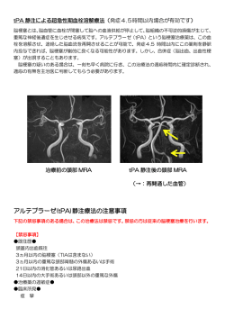 アルテプラーゼ(tPA)静注療法の注意事項
