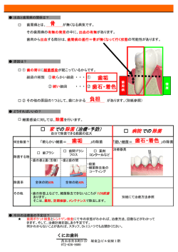 骨 歯垢 歯石・着色 負担 歯垢 歯石・着色