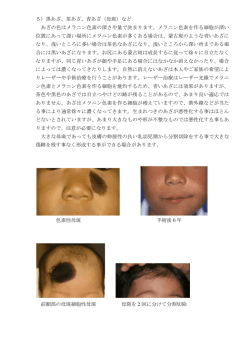 茶あざ、青あざ（母斑）(PDF : 328.51 KB)