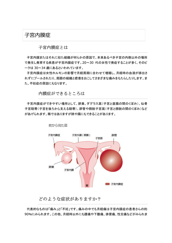 子宮内膜症