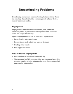 母乳育児のトラブル - Health Information Translations