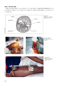 Part 2 - 赤十字国際委員会
