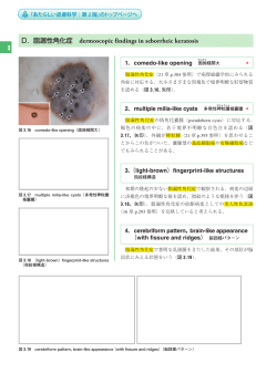 З D．脂漏性角化症 dermoscopic findings in seborrheic keratosis
