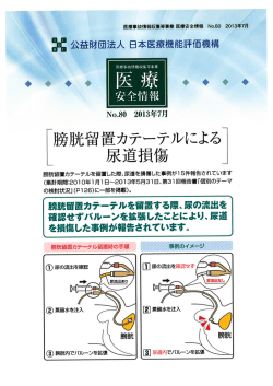 勝 &rdquo;留置カテ二孟ルによる