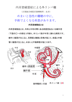内耳窓破裂症による外リンパ瘻 めまいと急性の難聴の中に