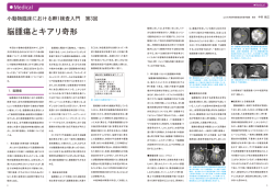 小動物臨床におけるMRI検査入門 第3回 脳腫瘍とキアリ奇形