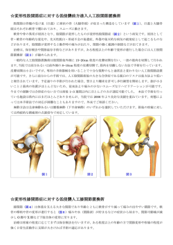 変形性股関節症に対する低侵襲前方進入人工股関節置換術 変形性膝