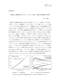 診断用 X 線画像におけるノイズの二面性－確率共鳴現象の