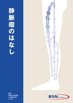 静脈瘤のはなし