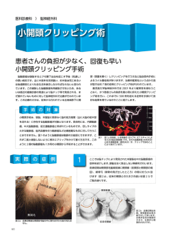7.小開頭クリッピング術