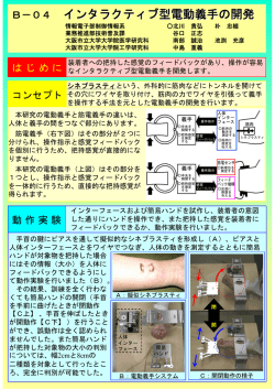 B－04 インタラクティブ型電動義手の開発