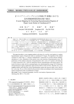 Z スコアマッピングによる単純 CT 画像における 急性期脳梗塞低吸収域