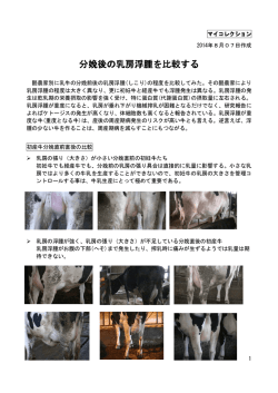 分娩後の乳房浮腫を比較する