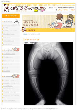 こどものよくある病気 くる病 ビタミンD欠乏症