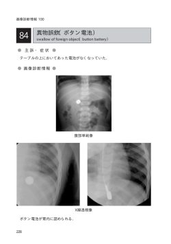 異物誤飲（ボタン電池）