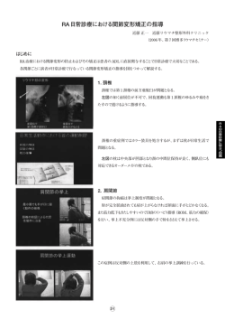 RA日常診療における関節変形矯正の指導