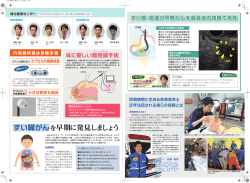すい臓がんを早期に発見しましょう