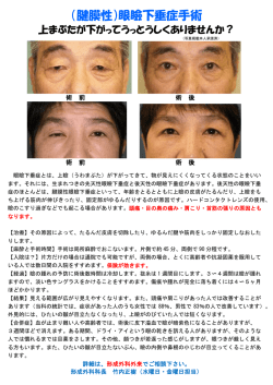 （腱膜性）眼瞼下垂症手術