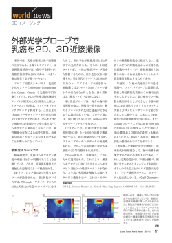 外部光学プローブで 乳癌を2D - Laser Focus World Japan