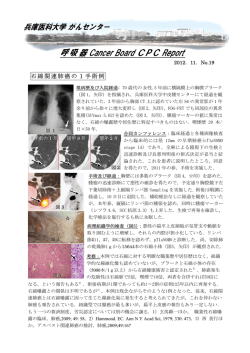 石綿関連肺癌の 1 手術例