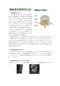胸椎黄色靭帯骨化症