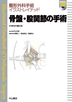 骨盤・股関節の手術