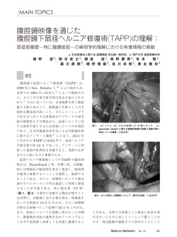 腹腔鏡映像を通じた 腹腔鏡下鼠径ヘルニア修復術(TAPP)の理解：