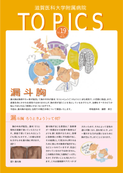 漏斗胸 漏斗胸 - 滋賀医科大学